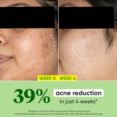 Dot & Key CICA Calming Skin Renewing Night Gel | For Oily, Acne Prone And Sensitive Skin | Night Cream with Niacinamide, Green Tea & Hyaluronic | Fades Blemishes & Dark Spots | 60ml