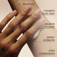 VEDICDERM Psoréa Cream with 2% Bakuchi Extract Skin Barrier Repair | Itching and Dryness Control | Natural, Chemical Free Formula for Psoriatic skin (200ml, Pack of 1)