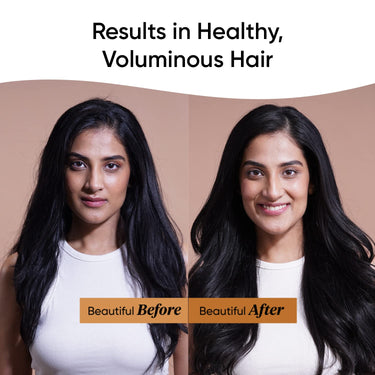 Dot & Key Moringa & Argan Hair Fall Control Shampoo With Pea Peptide & Cysteine | Sulphate Free, Paraben Free | For Dull & Thinning Hair | 200ml