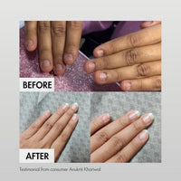 Hibiscus Monkey Nailed It, Repairs Cuticle & Nail Overnight, Stimulates Nail Growth, For Damaged Skin & Thin Nails - 100% Natural, Paraben Free, Cruelty Free - Jojoba & Myrrh, 10ml