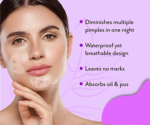 Urban Yog Acne Pimple Patch - Invisible Facial Stickers Cover With 100% Hydrocolloid, Pimple / Acne Absorbing Patch (Curvy Pimple Patch) - Pack Of 1