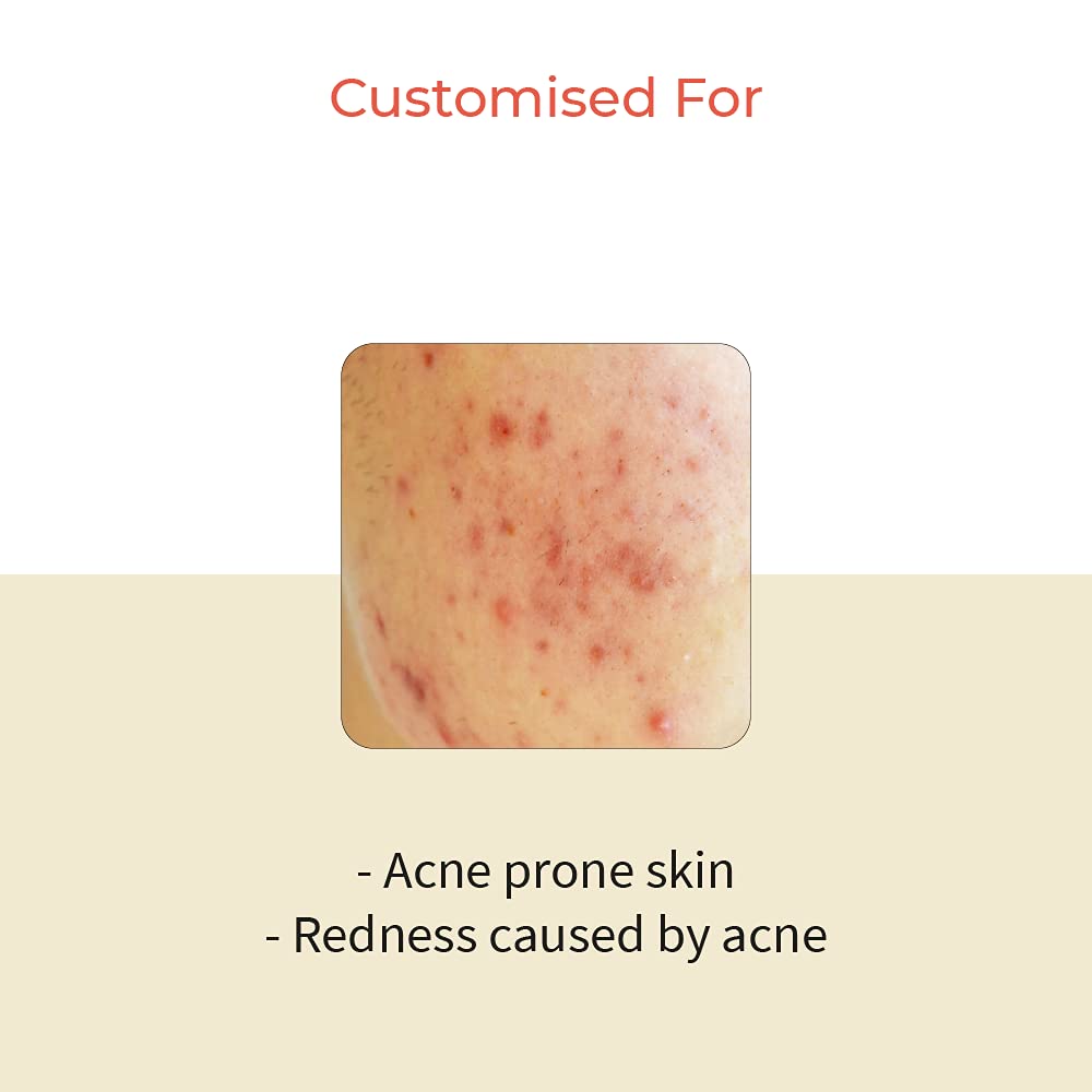 Vedix Customized Face Pack - Avasya Clarifying Clay Mask For Acne Prone Skin With Kumari + Tea Tree + Kaolin