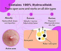 Urban Yog Acne Pimple Patch - Invisible Facial Stickers Cover With 100% Hydrocolloid, Pimple / Acne Absorbing Patch (Curvy Pimple Patch) - Pack Of 1