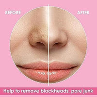 Luxenwell Deep Purifying Nose Strips for Women & Men | Enriched with Bamboo Charcoal | For Instant And Painless Blackheads And Whiteheads Removal (Pack of 20)