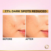 L'Oreal Paris Glycolic Bright 8% [Melasyl + Niacinamide] Face Serum for Brightening Dark Spots 15ml