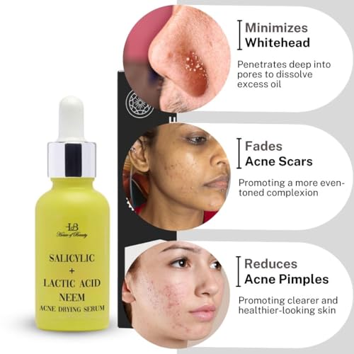 House of Beauty Acne Drying Serum - 30ml