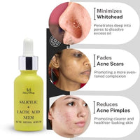 House of Beauty Acne Drying Serum - 30ml