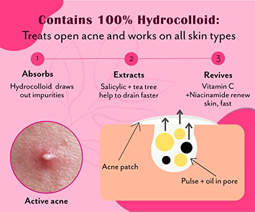 Urban Yog Acne Pimple Patch - Invisible Facial Stickers Cover With 100% Hydrocolloid, Pimple / Acne Absorbing Patch (Rectangular Pimple Patch) - Pack Of 1