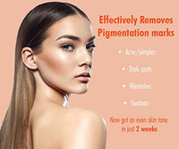 Urban Yog Anti-Pigmentation Serum with 10% Niacinamide 1% Zinc PCA | Face Serum for Acne-Prone Skin & Acne Marks for Women and Men | Anti-aging serum for pigmentation and dark spot | 30 ml