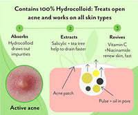 Urban yog Acne Pimple Patch - 72 Invisible Facial Stickers cover with 100% Hydrocolloid (Acne Pimple Patch (Pack of 2))