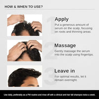 Bare Anatomy Expert Anti-Dandruff Shampoo + Mask | Dandruff Reduction | Targets Oily Scalp & Sheds Dry Flakes | Advanced Hair Growth Serum |Hair growth & Hair fall control serum for Women & Men