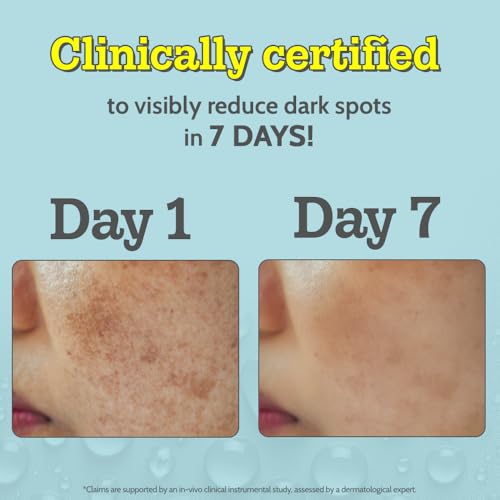 Chemist At Play 10% Vitamin C Face Serum | Brightens & Gives Glow | Fades Dark Spots | Treats Hyperpigmentation | Balances Melanin Production | Ethyl Ascorbic Acid & Glucosamine | For Oily, Combination, Sensitive Skin Types | Beginner Friendly & Highly St