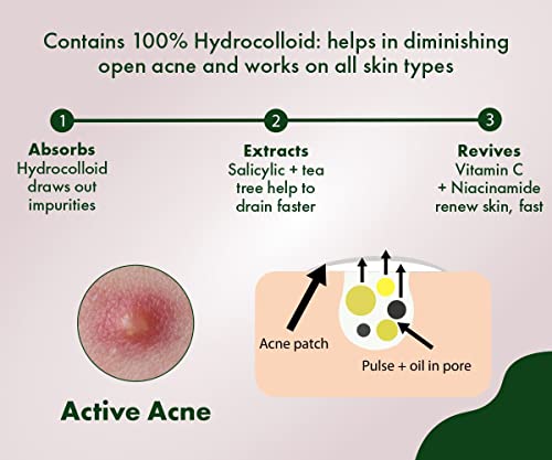 Urban yog Acne Pimple Patch - Invisible Facial Stickers cover with 100% Hydrocolloid, Pimple Patches for Face (Circular 36 Dots)