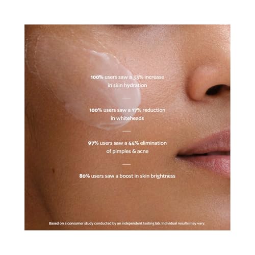 Akind On Cloud Nine Lightweight Moisturiser | Daily Lightweight Moisturiser | For All Skin Types | Skin Barrier Build range | Probiotics, Peptide Complex, Ceramide Complex