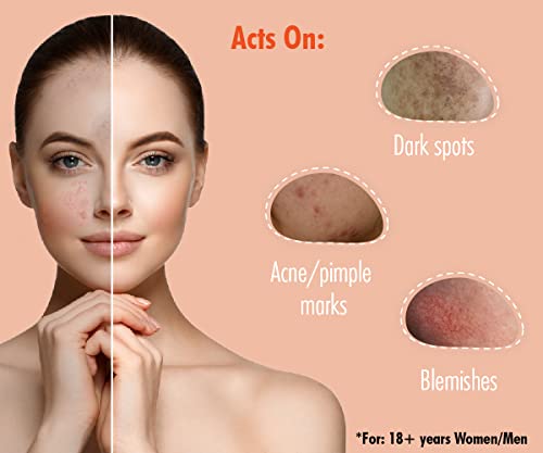 Urban Yog Anti-Pigmentation Serum with 10% Niacinamide 1% Zinc PCA | Face Serum for Acne-Prone Skin & Acne Marks for Women and Men | Anti-aging serum for pigmentation and dark spot | 30 ml