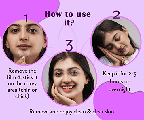 Urban Yog Acne Pimple Patch - Invisible Facial Stickers Cover With 100% Hydrocolloid, Pimple / Acne Absorbing Patch (Curvy Pimple Patch) - Pack Of 1