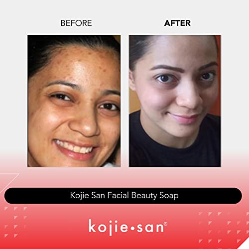 Kojie San Original Facial Beauty Soap - 65G, 3 Bars Per Pack - Guaranteed Authentic