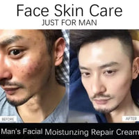 AV Herbal International Moisturizing Balm 50g Daily face care for all skin types | Hydrates, softens & smooths skin | Gentle, natural formula for day & night use (1)