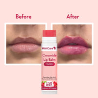 WishCare Tinted Lip Balm with SPF 50 PA+++ - Brightening Lip Balm for Dark Lips with Kojic Acid & Niacinamide- SPF lip balm for Women 5g