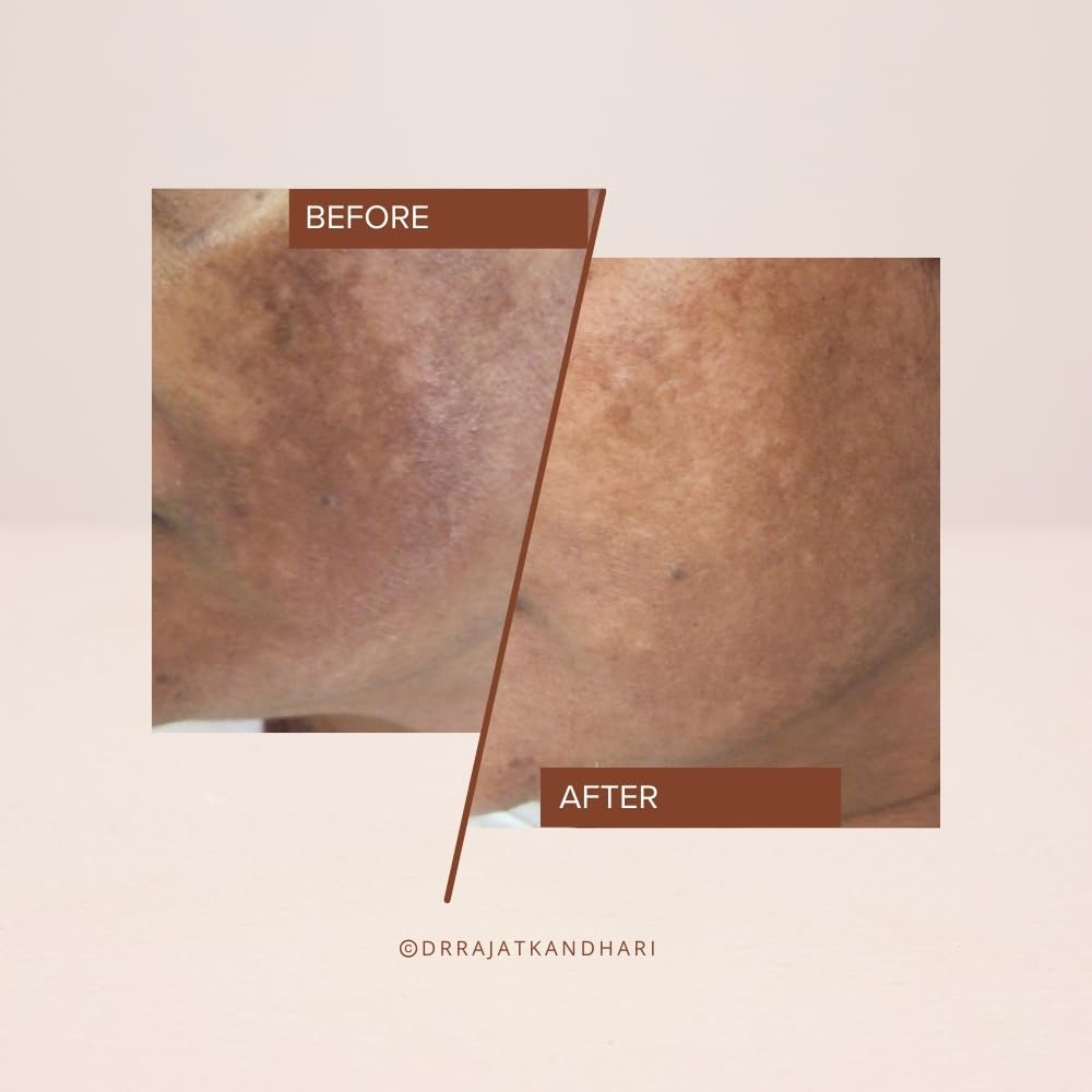 The Facecraft Project Gentle Face Exfoliate | Hydrating Ingredients | No Dryness | Daily Skin Care Essential | (10ml)