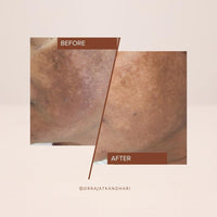 The Facecraft Project Gentle Face Exfoliate | Hydrating Ingredients | No Dryness | Daily Skin Care Essential | (10ml)