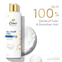 Dove Anti Dandruff Solutions Shampoo 340 ml|| Prevents Dandruff & Dry Scalp|| Mild Daily Shampoo for Smooth & Frizz Free Hair - For Men & Women