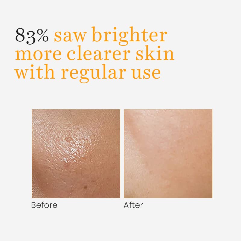 O3+ Vitamin C Glowing Face Wash 100g for Men & Women with Turmeric & Licorice Extract | Ideal for Combination Skin, Men & Women