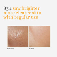 O3+ Vitamin C Glowing Face Wash 100g for Men & Women with Turmeric & Licorice Extract | Ideal for Combination Skin, Men & Women
