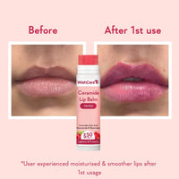 WishCare Tinted & Untinted Ceramide Lip Balm for Dark Lips with SPF 50 & Kojic Acid (5gm + 5gm)