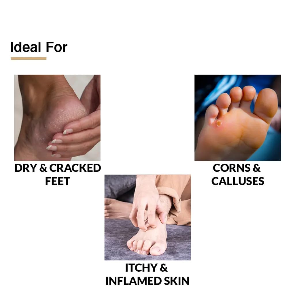Fixderma 5% Lactic Acid, 15% Urea, 3% Glycerine, Foot Cream For Dry & Cracked Feet, Moisturizes and Soothes Feet, Heel Repair Paraben & Sulphate Free, All Skin Types 60ml (Pack of 2)