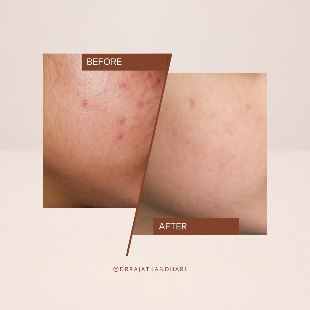 THE FACECRAFT PROJECT Exfoliate Gentle Face Formula | Smooth Texture | Hydrating | Daily Use |(30ml)