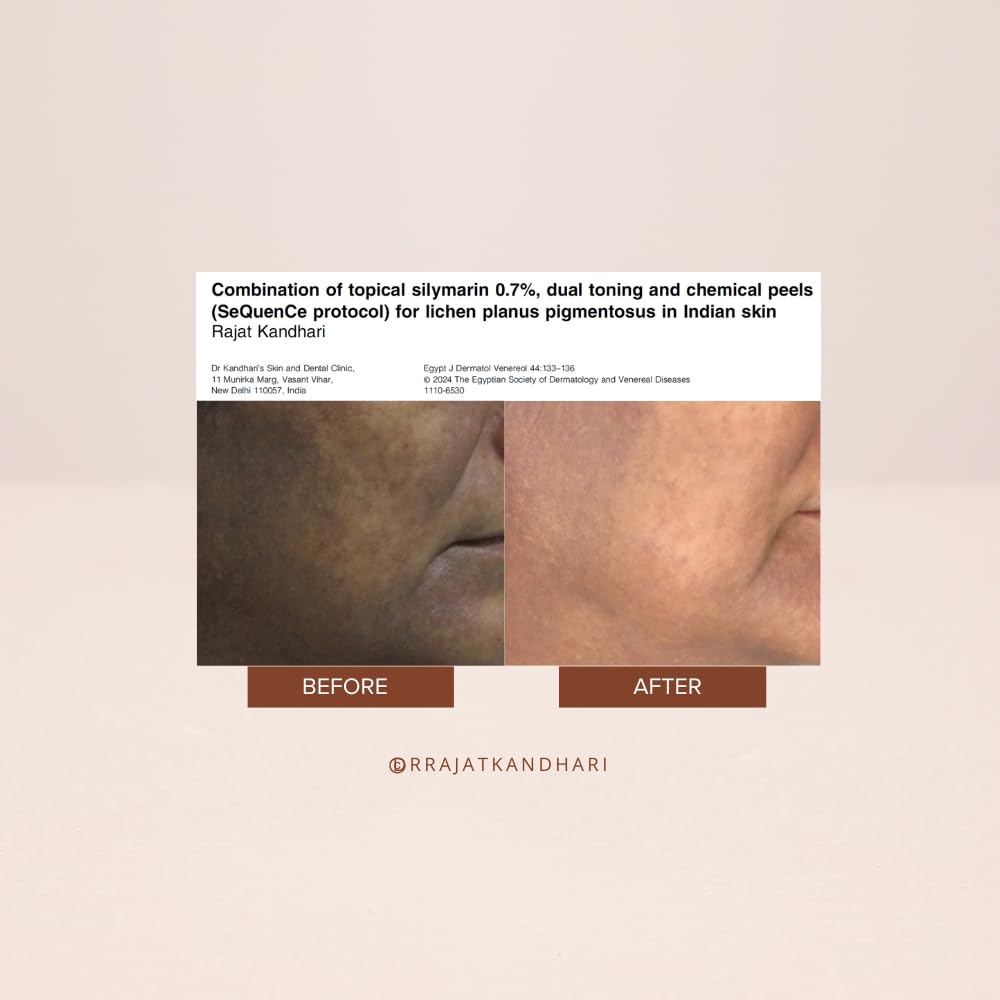 THE FACECRAFT PROJECT Retinol Night Cream Hydrating & Nourishing Formula |Hyaluronic Acid Blend |Smooth & Supple Skin |Pore Care |Lightweight Texture | Restorative Skincare |Daily Night Routine (50gm)