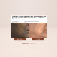 THE FACECRAFT PROJECT Retinol Night Cream Hydrating & Nourishing Formula |Hyaluronic Acid Blend |Smooth & Supple Skin |Pore Care |Lightweight Texture | Restorative Skincare |Daily Night Routine (50gm)