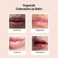 SUGANDA CALENDULA LIP BALM | with COCOA BUTTER & AVOCADO| NOURSHING Lip Oil for DRY CHAPPED LIPS | Lip care to HEAL CRACKED AND WOUNDED LIPS | RETAIS MOISTURE | Winter care moisturizer | 4g - White