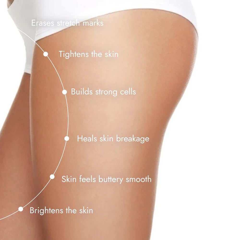 Cos-IQ Stretch Marks Removal Roll-On Serum (Pack of 3 X 40ml Each) | with Striover | Scar Removal | Uneven Skin Tone | All Skin Types | 120ml