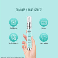 Dermafique Acne Avert Spot Corrector Face Serum with 2.5% Azelaic Acid, 15 ml, Serum for Oily - Acne Prone Skin, Dermatologist Tested on Indian Skin, Reduces Acne Severity in One Day*, For Women & Men