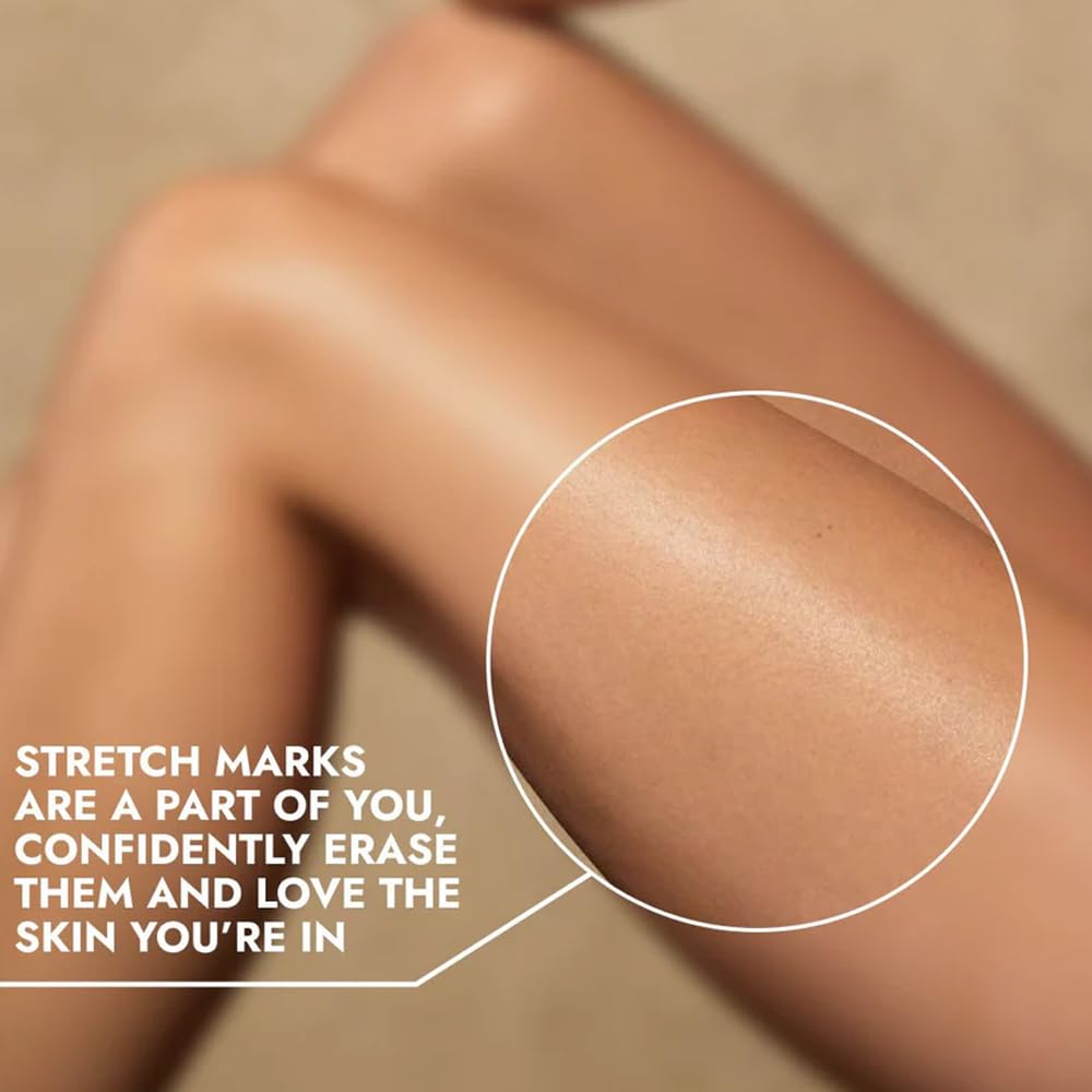 Cos-IQ Stretch Marks Removal Roll-On Serum (Pack of 3 X 40ml Each) | with Striover | Scar Removal | Uneven Skin Tone | All Skin Types | 120ml