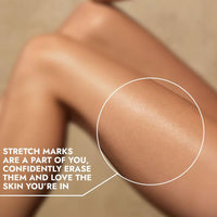 Cos-IQ Stretch Marks Removal Roll-On Serum (Pack of 3 X 40ml Each) | with Striover | Scar Removal | Uneven Skin Tone | All Skin Types | 120ml