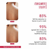 THE LOVE CO Salicylic Acid 02% Body Wash - Body & Back Acne | Paraben & SLS Free | Prevents Dry, Rough, Bumpy, and Strawberry Skin | Deep Cleanses Skin | For Men & Women | Body Shower Gel 250ml
