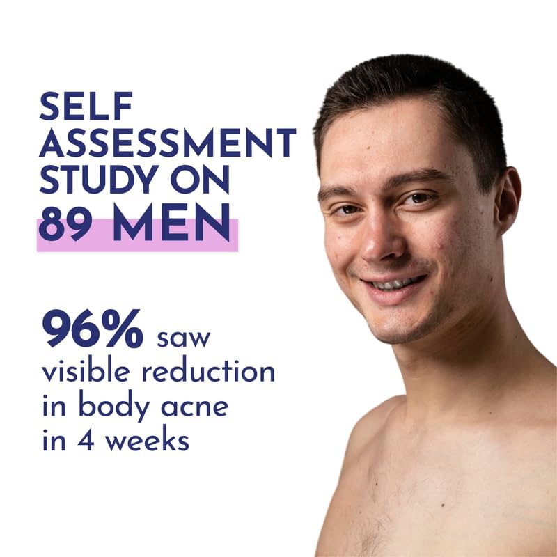 Mannlich 2% Salicylic Acid Body Acne Wash for Men (300 ml) - Bacne Clear Body Wash Men Shower Gel - 3% Niacinamide Prevents Body Acne, Exfoliates & Nourishes Skin - Suitable for All Skin Types - Paraben & SLS Free