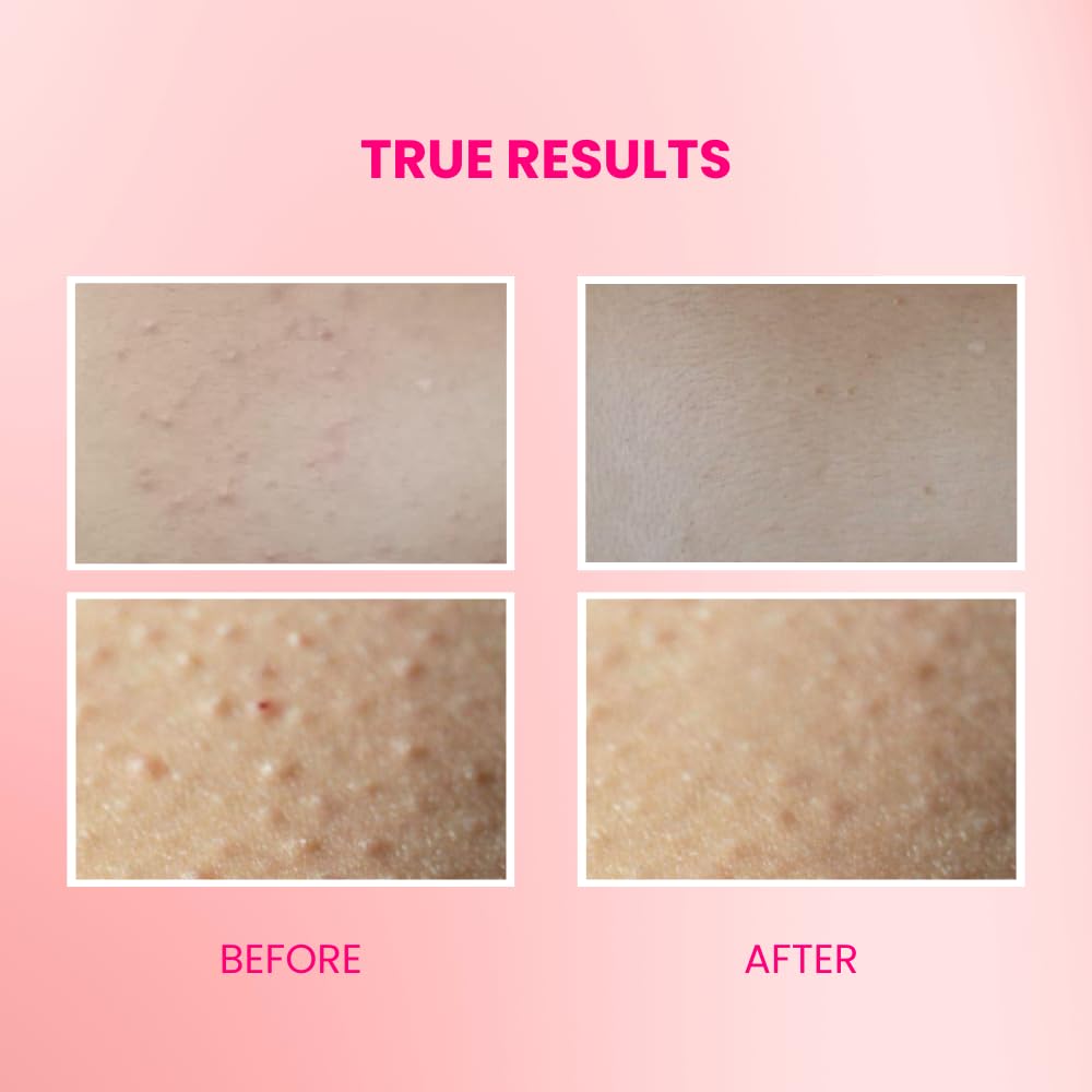 Suroskie Velvet Glaze Exfoliating Glow 2 In 1 Body Scrub Wash | With Salicylic/Glycolic Extract & Niacinamide | For Body Acne, Tan Removal, Glowing Skin | Body Wash Shower Gel For Women & Men