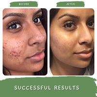 Mystiq Living Face Scrub for Men and Women | Green Coffee Blemish Clear Scrub - 100 GM | Exfoliating Scrub, Dark Spot Removal, Pigmentation, Skin Brightening | Tan Removal Coffee Scrub