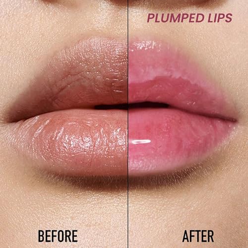 Shopaarel Little Flower Lip Gloss, Lip Gloss, Infused with Real Flower Seed Oil and Fruit Oils, Floral Fragrance, Glossy finish, Long-Lasting, Non-Sticky, Fuller & Plump Lips-8 Gm, Delicious