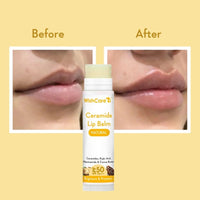 WishCare Lip Balm with SPF 50 PA+++ - Brightening Lip Balm for Dark Lips with Kojic Acid & Niacinamide - SPF lip balm for Women & Men 5g