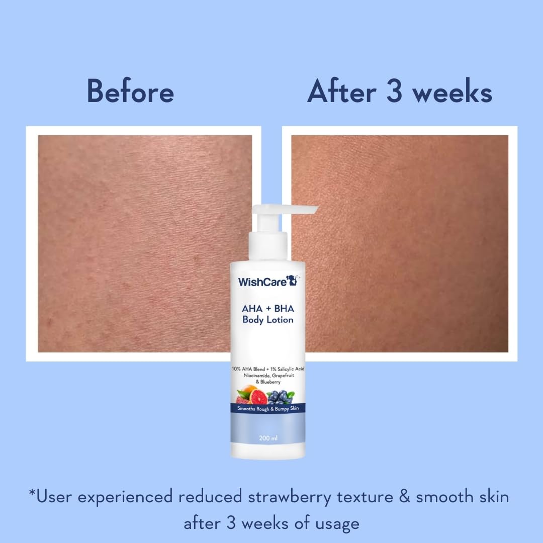 WishCare 10% AHA + 1% BHA Body Lotion for Men & Women - Body lotion for dry skin - Detans, Smooths Rough & Bumpy Skin 200ml