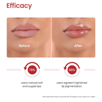 Earth Rhythm Lip Mask with Goodness of Pomegranate & Jojoba Oil, Nourishes, Smoothens, Plumps & Hydrates Dry Chapped Lips, Women & Girls, Paraben & Chemical Free, 10ml