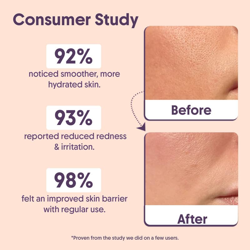 Aravi Organic Advanced Barrier Repair Moisturizer - With Ceramide, Peptide, Hyaluronic Acid & Cica - For Deep Moisturizing, Strengthening & Skin Barrier Repair - For All Skin Types - 100 gm