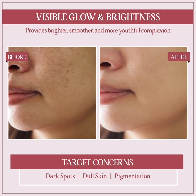 TYC - TRUST YOUR CHOICE Ayurveda Glycobright Day SPF-30 Face Cream For Bright And Glowing Skin With 1% Glycolic And Shankhapushpi, Plant Based - 50 gm (Pack of 1)