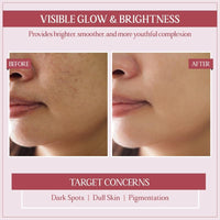 TYC - TRUST YOUR CHOICE Ayurveda Glycobright Day SPF-30 Face Cream For Bright And Glowing Skin With 1% Glycolic And Shankhapushpi, Plant Based - 50 gm (Pack of 1)