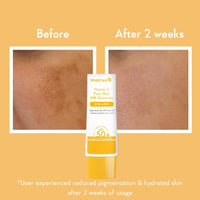 WishCare Super Bright Vitamin C Face Serum and Vitamin C Pure Glow Milk Sunscreen with SPF 50 PA+++(30ml + 50ml)